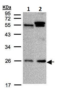 Western blot - Anti-Rab5A antibody - C-terminal (AB228770), expandable thumbnail