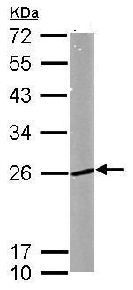 Western blot - Anti-Rab5A antibody - C-terminal (AB228770), expandable thumbnail