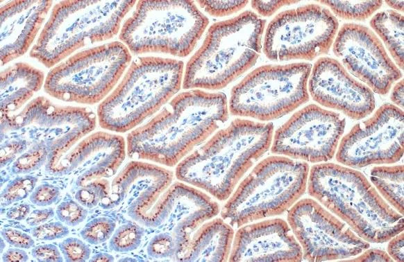 Immunohistochemistry (Formalin/PFA-fixed paraffin-embedded sections) - Anti-RAB6A antibody [HL1047] (AB308377)