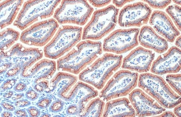 Immunohistochemistry paraffin embedded sections - Anti-RAB6A antibody [HL1047] (AB308377)