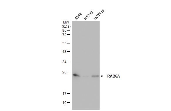 Western blot - Anti-RAB6A antibody [HL1047] (ab308377), expandable thumbnail