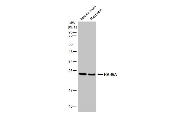 Western blot - Anti-RAB6A antibody [HL1047] (AB308377), expandable thumbnail