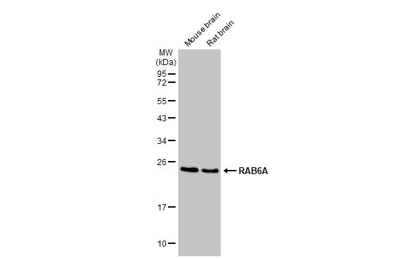 Western blot - Anti-RAB6A antibody [HL1047] (AB308377)