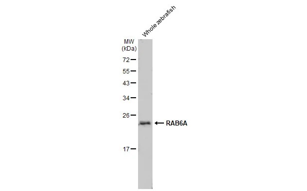 Western blot - Anti-RAB6A antibody [HL1047] (AB308377), expandable thumbnail