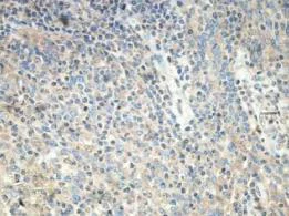 Immunohistochemistry (Formalin/PFA-fixed paraffin-embedded sections) - Anti-RAB6B antibody (AB206110)