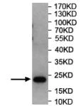 Western blot - Anti-RAB6B antibody (AB206110)