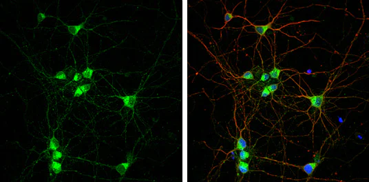 Immunocytochemistry/ Immunofluorescence - Anti-RAB7 antibody (AB229647)