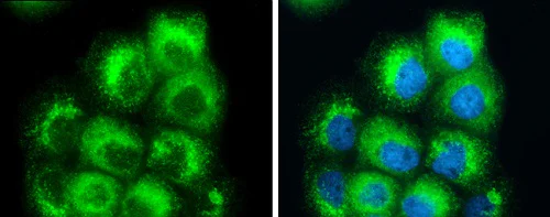 Immunocytochemistry/ Immunofluorescence - Anti-RAB7 antibody (AB229647)
