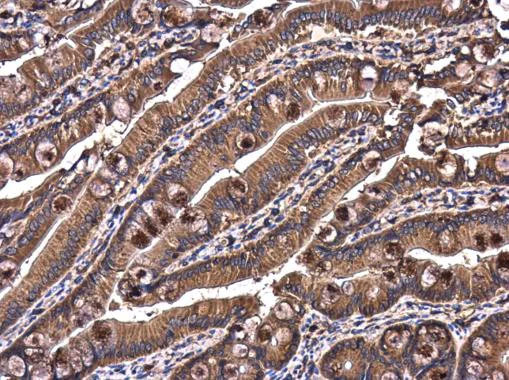 Immunohistochemistry (Formalin/PFA-fixed paraffin-embedded sections) - Anti-RAB7 antibody (AB229647)