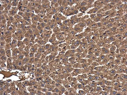 Immunohistochemistry (Formalin/PFA-fixed paraffin-embedded sections) - Anti-RAB7 antibody (AB229647)