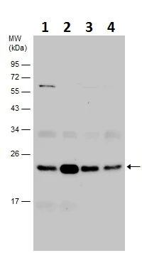 Western blot - Anti-RAB7 antibody (AB229647)