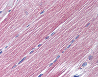 Immunohistochemistry (Formalin/PFA-fixed paraffin-embedded sections) - Anti-RAB7 antibody (AB77993), expandable thumbnail