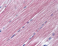 Immunohistochemistry (Formalin/PFA-fixed paraffin-embedded sections) - Anti-RAB7 antibody (AB77993)