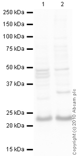 Western blot - Anti-RAB7 antibody (AB77993), expandable thumbnail