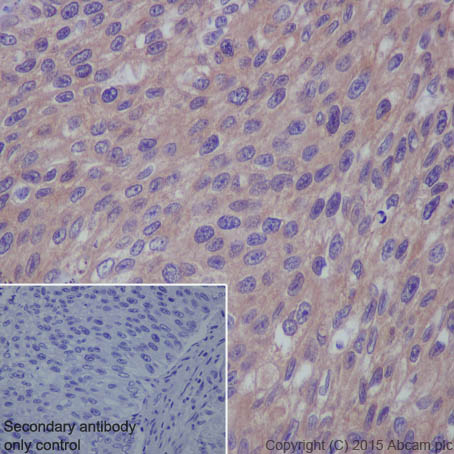 Immunohistochemistry (Formalin/PFA-fixed paraffin-embedded sections) - Anti-RAB7 antibody [EPR7588(B)] - BSA and Azide free (AB238990)