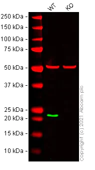 Western blot - Anti-RAB7 antibody [EPR7588(B)] - BSA and Azide free (AB238990)