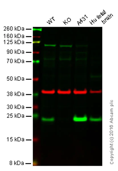 Western blot - Anti-RAB7 antibody [EPR7588(B)] - BSA and Azide free (AB238990)