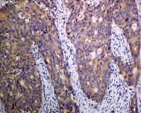 Immunohistochemistry (Formalin/PFA-fixed paraffin-embedded sections) - Anti-RAB7 antibody [EPR7588(B)] - Late Endosome Marker (AB126712)