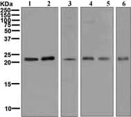 Western blot - Anti-RAB7 antibody [EPR7588(B)] - Late Endosome Marker (AB126712)
