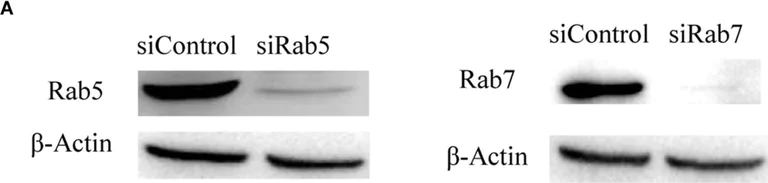 Western blot - Anti-RAB7 antibody [EPR7588(B)] - Late Endosome Marker (AB126712)