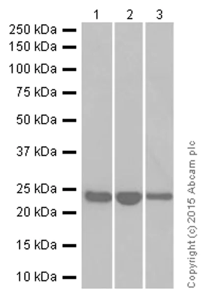 Western blot - Anti-RAB7 antibody [EPR7588(B)] - Late Endosome Marker (AB126712)