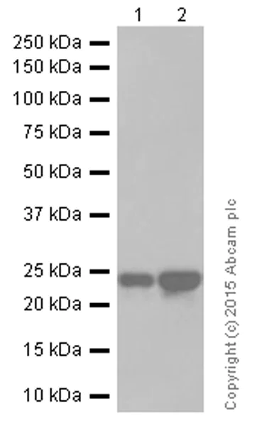 Western blot - Anti-RAB7 antibody [EPR7588(B)] - Late Endosome Marker (AB126712)