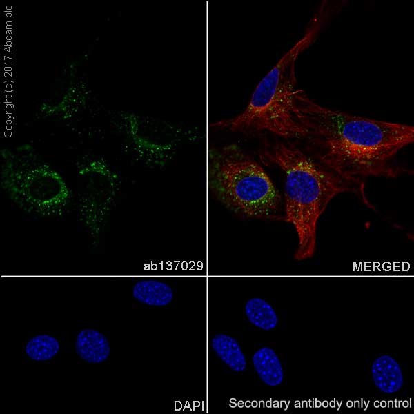 Immunocytochemistry/ Immunofluorescence - Anti-RAB7 antibody [EPR7589] (AB137029), expandable thumbnail