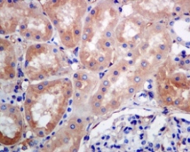 Immunohistochemistry (Formalin/PFA-fixed paraffin-embedded sections) - Anti-RAB7 antibody [EPR7589] (ab137029), expandable thumbnail