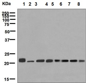 Western blot - Anti-RAB7 antibody [EPR7589] (ab137029), expandable thumbnail