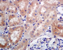 Immunohistochemistry (Formalin/PFA-fixed paraffin-embedded sections) - Anti-RAB7 antibody [EPR7589] - BSA and Azide free (AB214806)