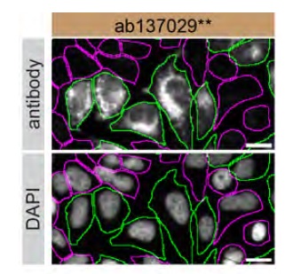 Immunocytochemistry/ Immunofluorescence - Anti-RAB7 antibody [EPR7589] (ab137029), expandable thumbnail