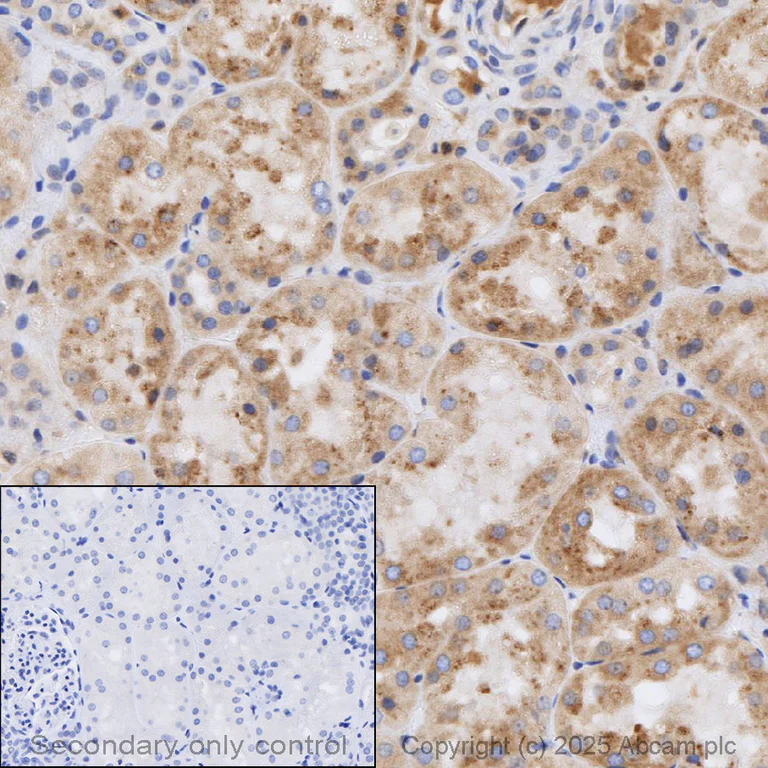 Immunohistochemistry (Formalin/PFA-fixed paraffin-embedded sections) - Anti-RAB7 antibody [EPR7589] - Late Endosome Marker (AB137029)