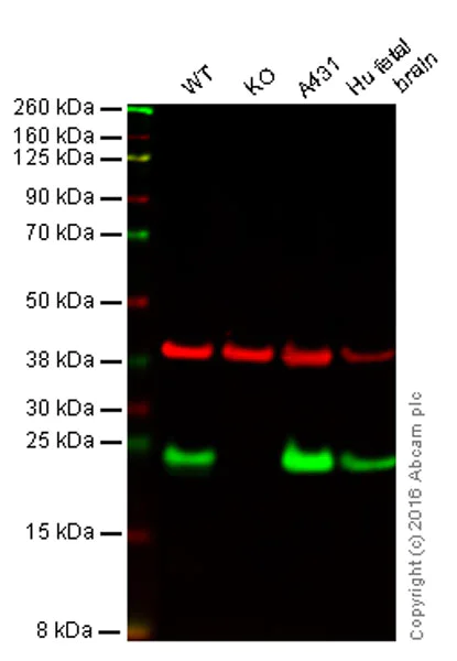 Western blot - Anti-RAB7 antibody [EPR7589] - Late Endosome Marker (AB137029)