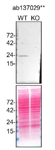 Western blot - Anti-RAB7 antibody [EPR7589] - Late Endosome Marker (AB137029)