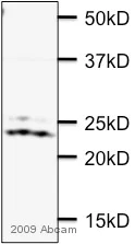 Western blot - Anti-RAB7 antibody [Rab7-117] - Late Endosome Marker (AB50533)