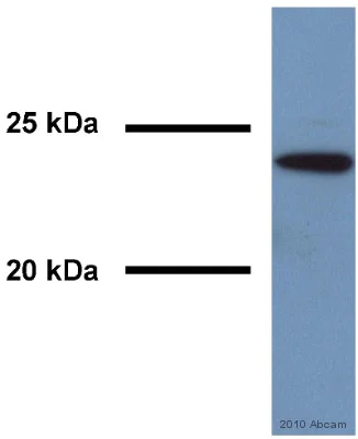 Western blot - Anti-RAB7 antibody [Rab7-117] - Late Endosome Marker (AB50533)