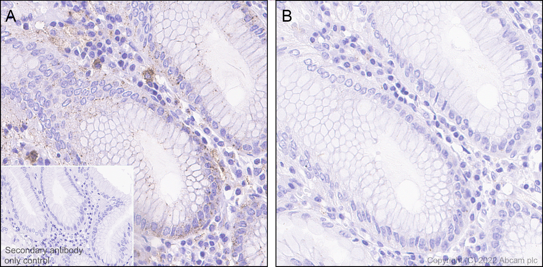 Immunohistochemistry (Formalin/PFA-fixed paraffin-embedded sections) - Anti-RAB7 (phospho S72) antibody [MJF-R38-1] (AB302494)