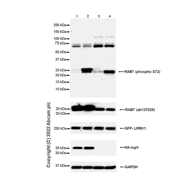 Western blot - Anti-RAB7 (phospho S72) antibody [MJF-R38-1] (AB302494)