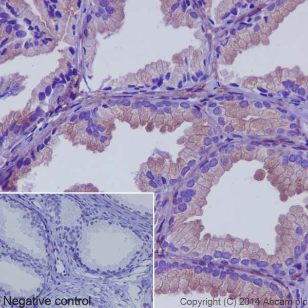 Immunohistochemistry (Formalin/PFA-fixed paraffin-embedded sections) - Anti-RAB7B antibody [EPR15727] (AB193360)