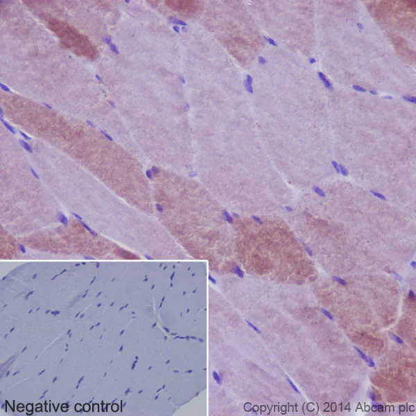Immunohistochemistry (Formalin/PFA-fixed paraffin-embedded sections) - Anti-RAB7B antibody [EPR15727] (AB193360)