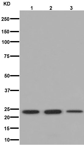 Western blot - Anti-RAB7B antibody [EPR15727] (AB193360)