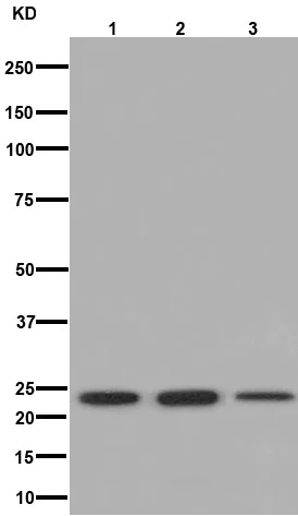 Western blot - Anti-RAB7B antibody [EPR15727] (AB193360)
