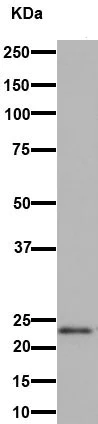 Western blot - Anti-RAB7B antibody [EPR15727] (AB193360)