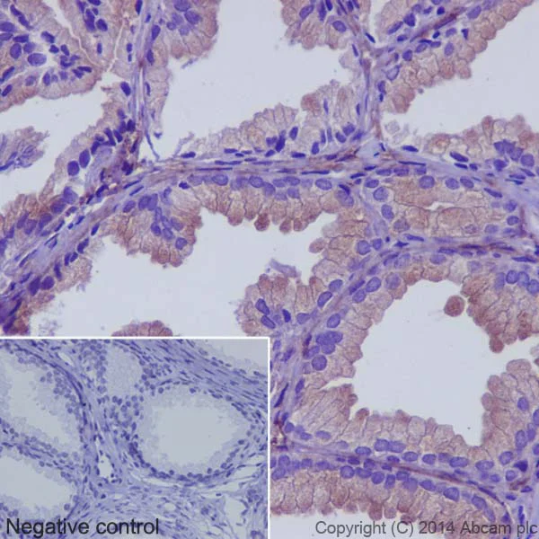 Immunohistochemistry (Formalin/PFA-fixed paraffin-embedded sections) - Anti-RAB7B antibody [EPR15727] - BSA and Azide free (AB240974)
