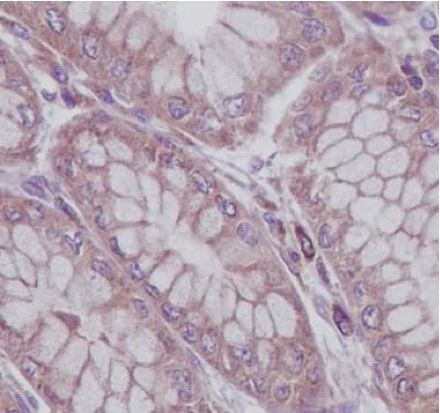 Immunohistochemistry (Formalin/PFA-fixed paraffin-embedded sections) - Anti-RAB8A antibody [EPR14873] (AB188574)