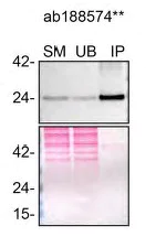 Immunoprecipitation - Anti-RAB8A antibody [EPR14873] (AB188574)