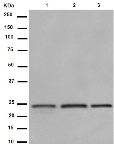 Western blot - Anti-RAB8A antibody [EPR14873] (ab188574), expandable thumbnail