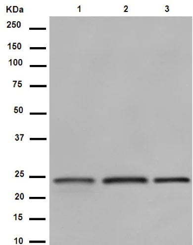 Western blot - Anti-RAB8A antibody [EPR14873] (AB188574)
