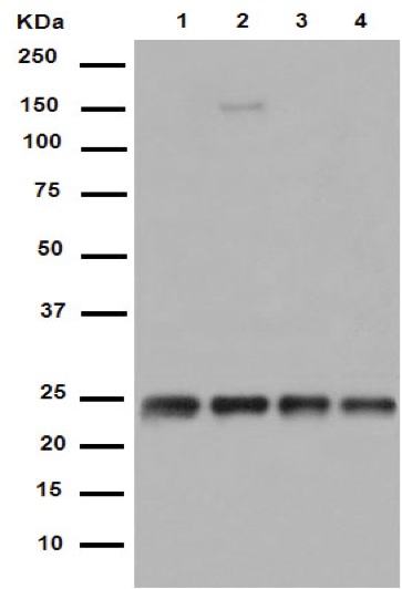 Western blot - Anti-RAB8A antibody [EPR14873] (AB188574), expandable thumbnail