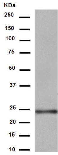 Western blot - Anti-RAB8A antibody [EPR14873] (ab188574), expandable thumbnail